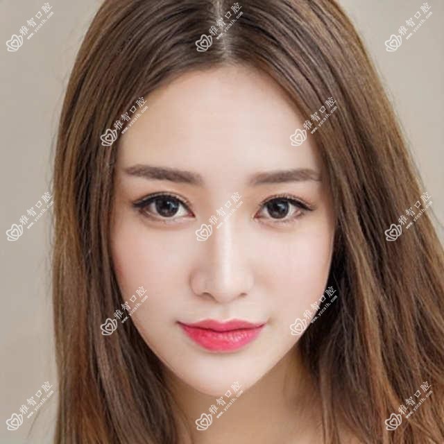 烟台3m黄金incognito舌侧矫正收费表-烟台哪些医院3m黄金incognito舌侧矫正疗效较好且费用合理