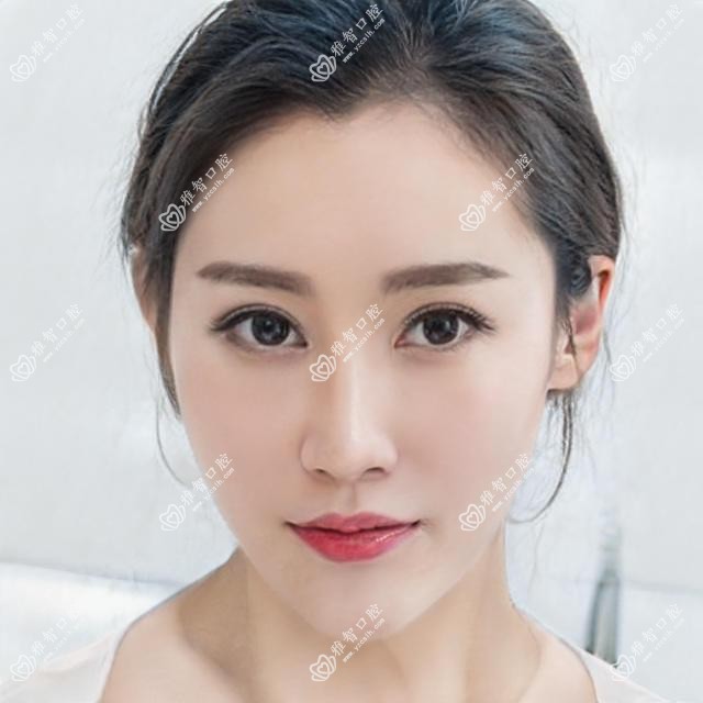 根管治疗怎么治疗?根管治疗相关治疗优缺点以及禁忌人群?