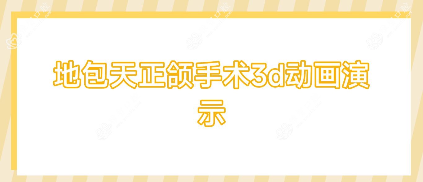 地包天正颌手术3d动画演示