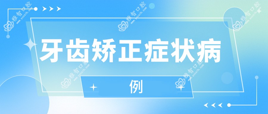 牙齿矫正症状病例