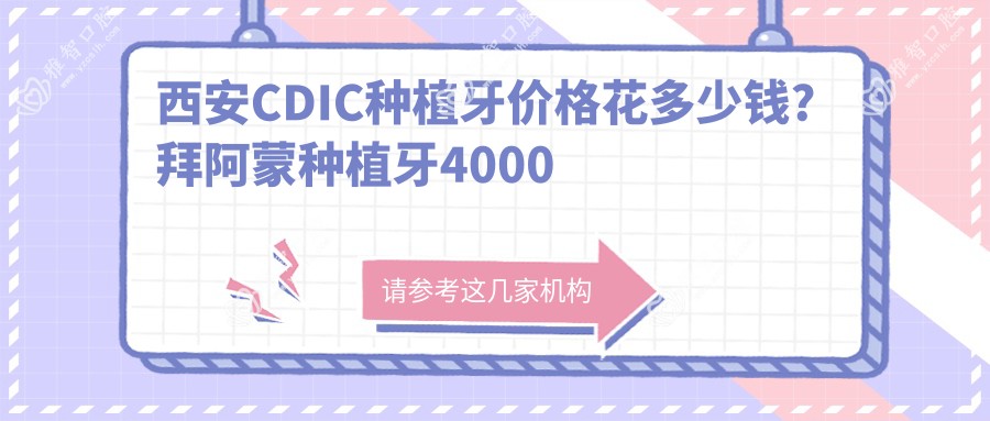 西安CDIC种植牙价格花多少钱?拜阿蒙种植牙4000元左右
