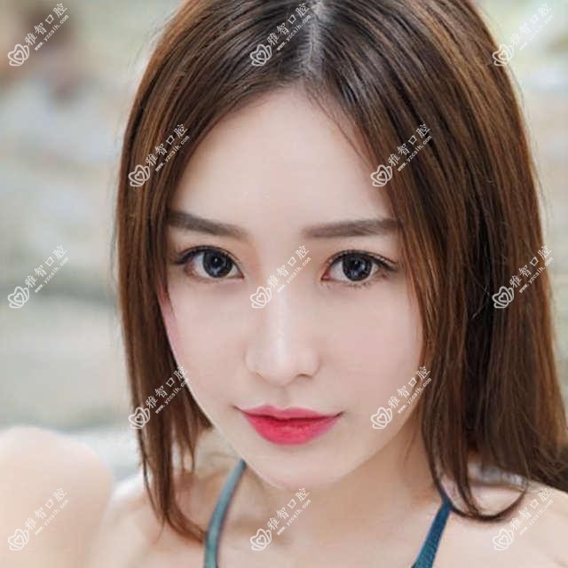 贵阳浅龋排名及费用介绍!便宜又好的医院是那家呢?