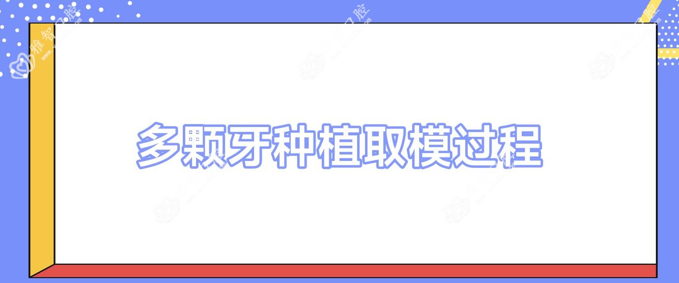 多颗牙种植取模过程