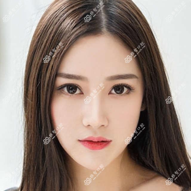 哈尔滨烂牙价目表总览,想变好看的朋友可以参考