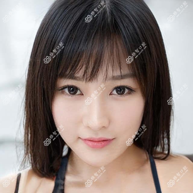 惠州美容冠是多少?惠州全瓷牙/二氧化锆全瓷牙/树脂贴面费用实惠