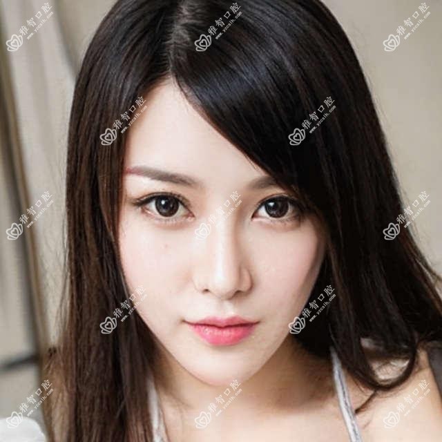 柳州洗牙/超声波洁牙价格明细一览表(2025柳州洗牙洗牙均价为:80元)
