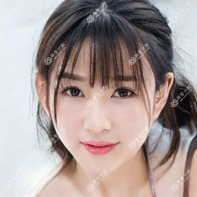 北京皓齿美白价格表-北京哪些医院皓齿美白结果很不错且收费不贵