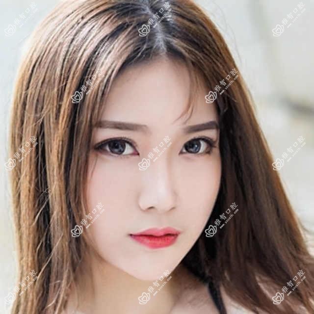 天津皓齿美白价格2025年新具体揭晓-/皓齿美白价目单(收费)
