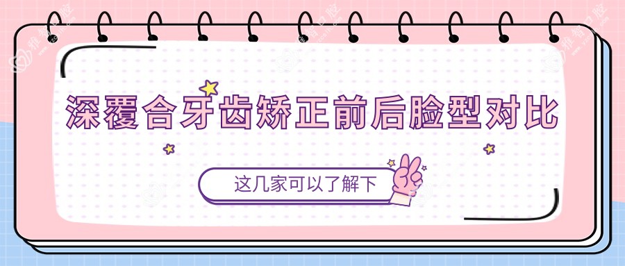 深覆合牙齿矫正前后脸型对比