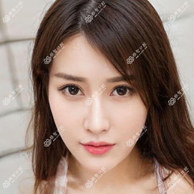 隐形托槽矫正怎么办?隐形托槽矫正治疗价格贵吗?