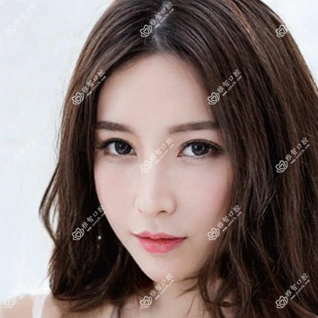 泉州烂牙排行榜前10医院名单+价格价格表介绍!技术较好医术精细