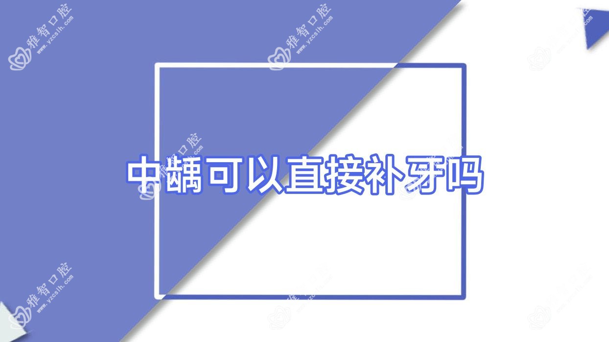 中龋可以直接补牙吗