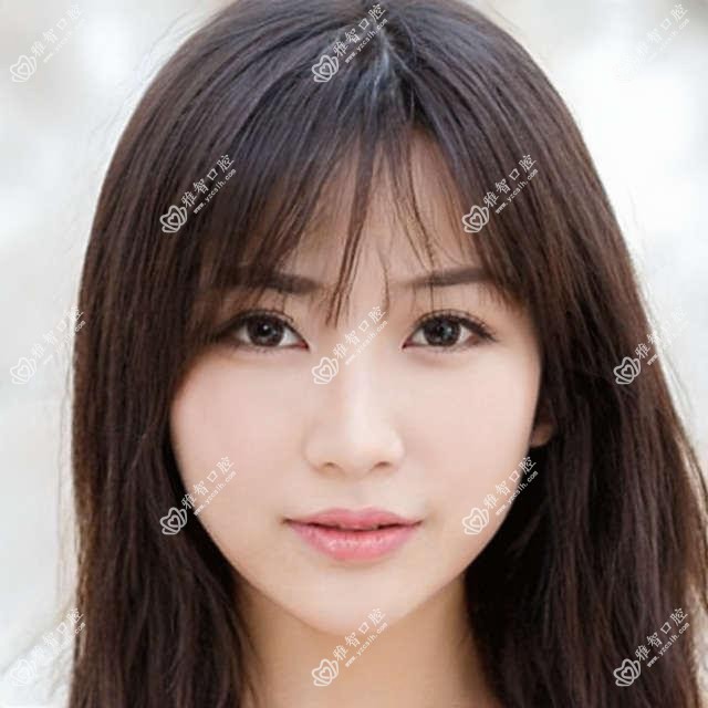 苏州韩国奥齿泰种植牙价格多少钱?2025价目表:美国百康种植牙12000元起、瑞典诺贝尔种植13000元起