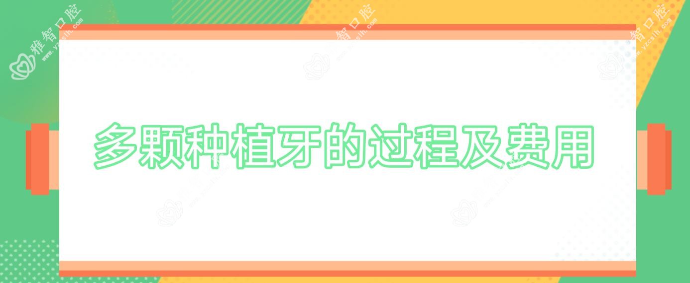多颗种植牙的过程及费用