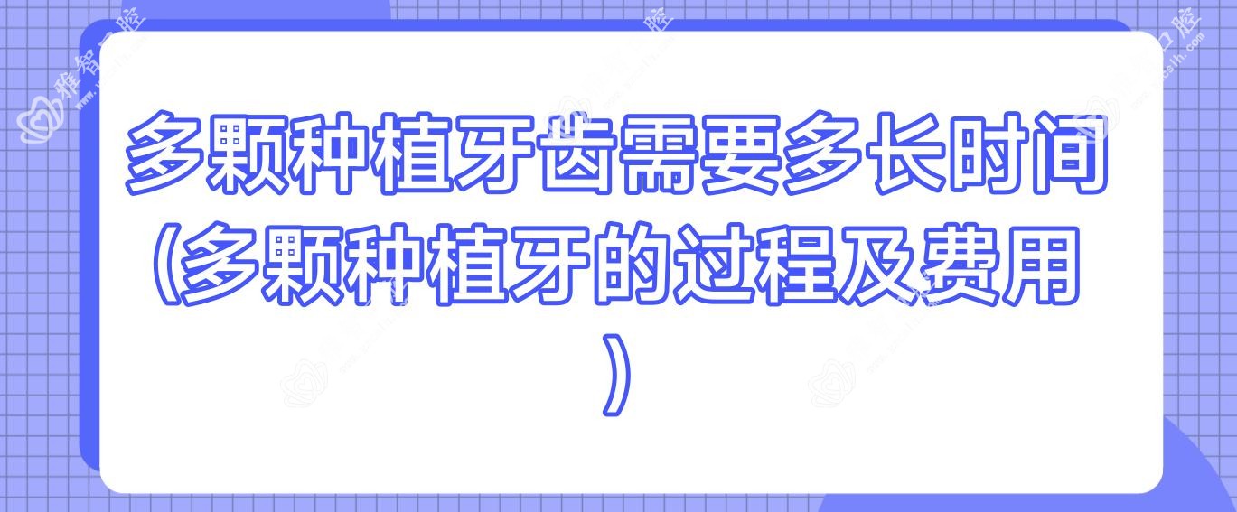 多颗种植牙齿需要多长时间(多颗种植牙的过程及费用)