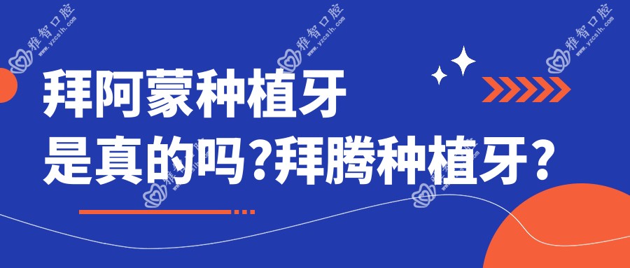 拜阿蒙种植牙是真的吗?拜腾种植牙?
