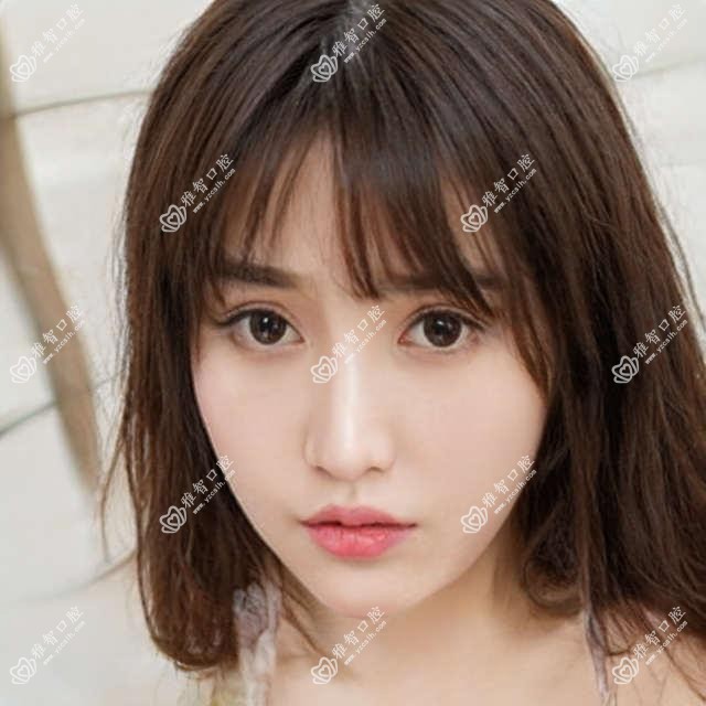 徐州德国费亚丹种植牙医院价目表(含徐州老兵口腔门诊部/益牙口腔(苏堤路店) /徐州邵慧口腔德国费亚丹种植牙费用)