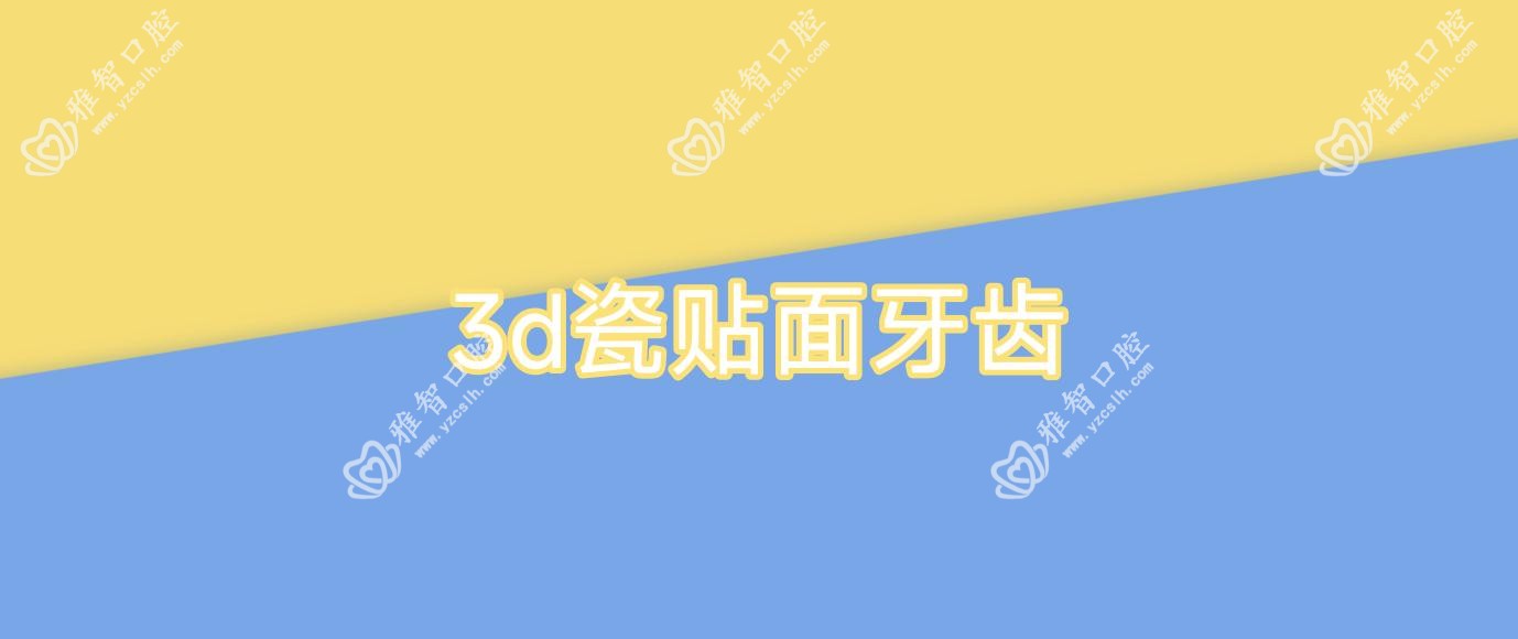3d瓷贴面牙齿