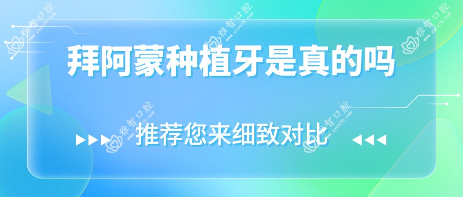 拜阿蒙种植牙是真的吗