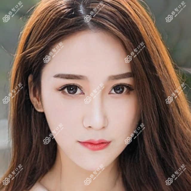 半口牙怎么样?半口牙相关操作详细介绍?