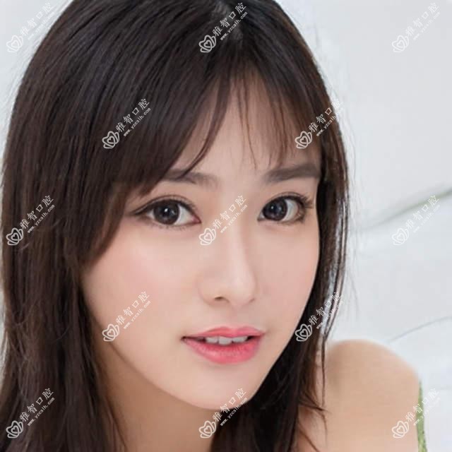 时代天使需要注意什么,时代天使相关治疗优缺点以及禁忌人群