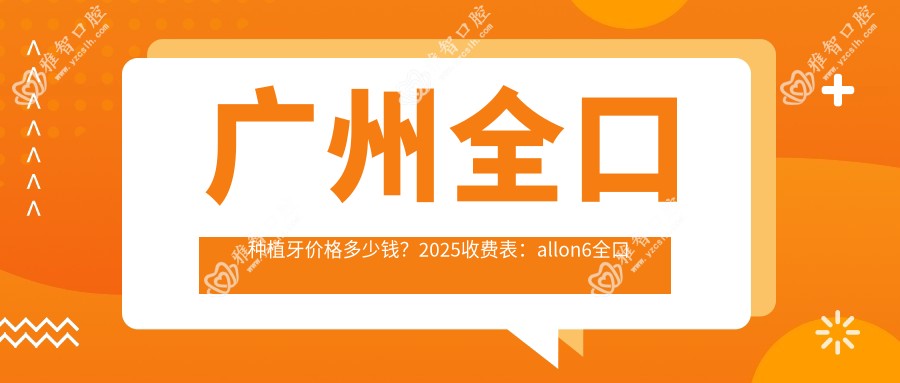 广州全口种植牙价格多少钱?2025收费表:allon6全口种植牙10w元起、全口即刻种植牙18w元起
