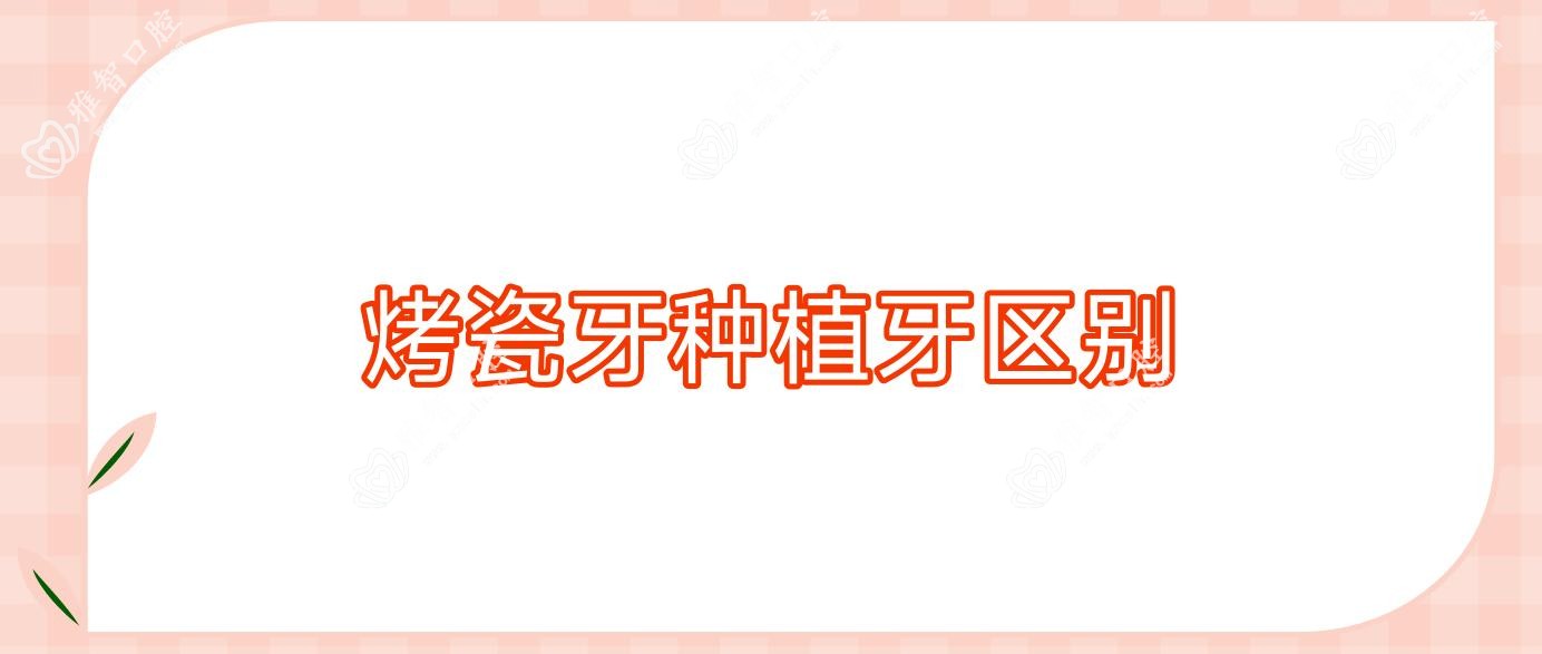 烤瓷牙种植牙区别