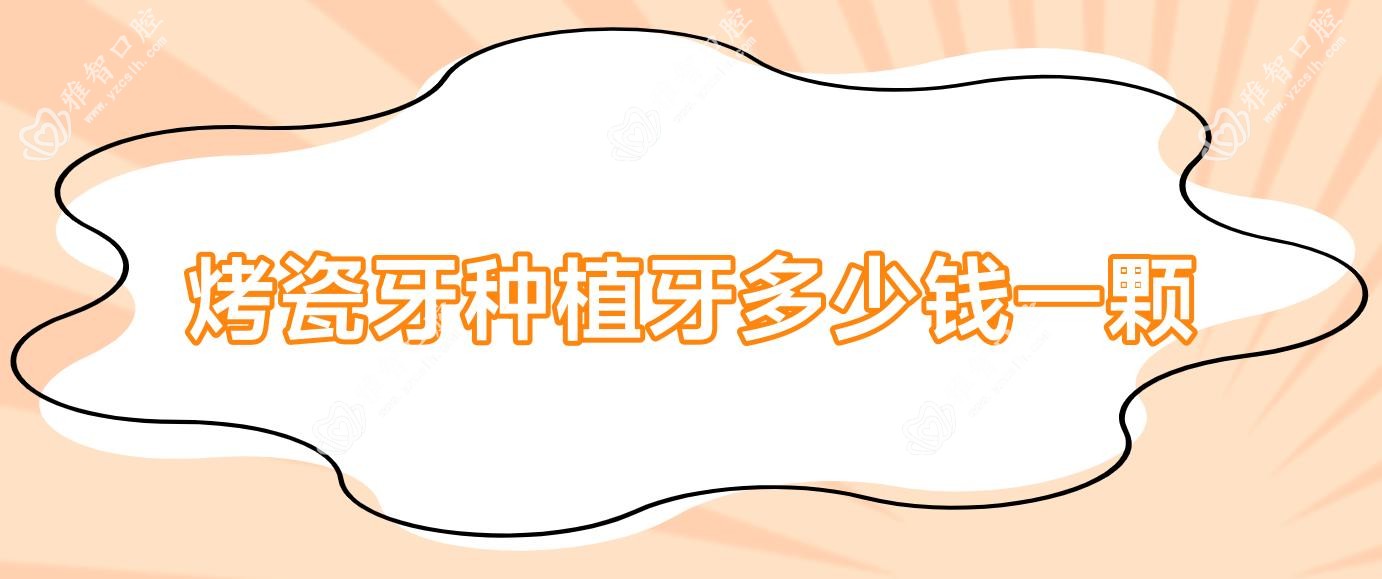 烤瓷牙种植牙多少钱一颗