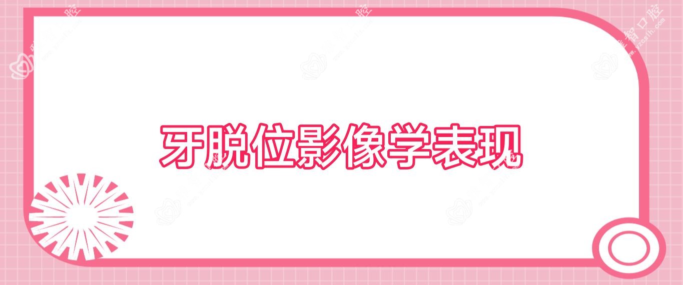 牙脱位影像学表现