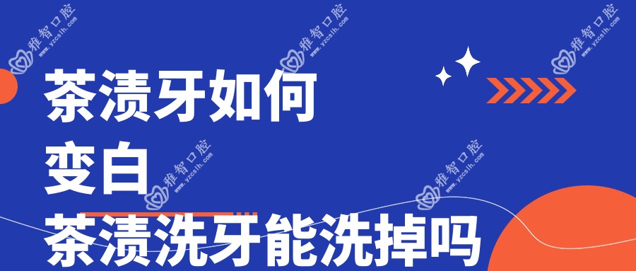 茶渍牙如何变白 茶渍洗牙能洗掉吗