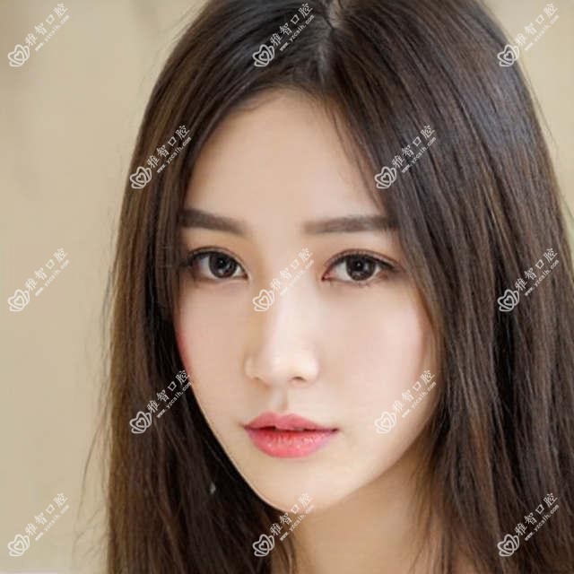 济南做咖啡牙美白多少钱?快点看喷砂洗牙和黑牙美白价目单