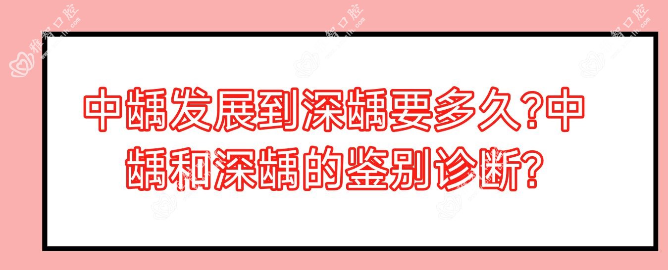 中龋发展到深龋要多久?中龋和深龋的鉴别诊断?