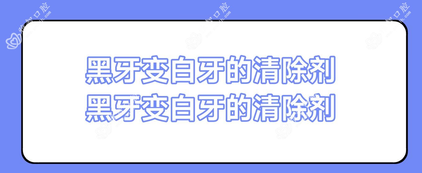 黑牙变白牙的清除剂 黑牙变白牙的清除剂