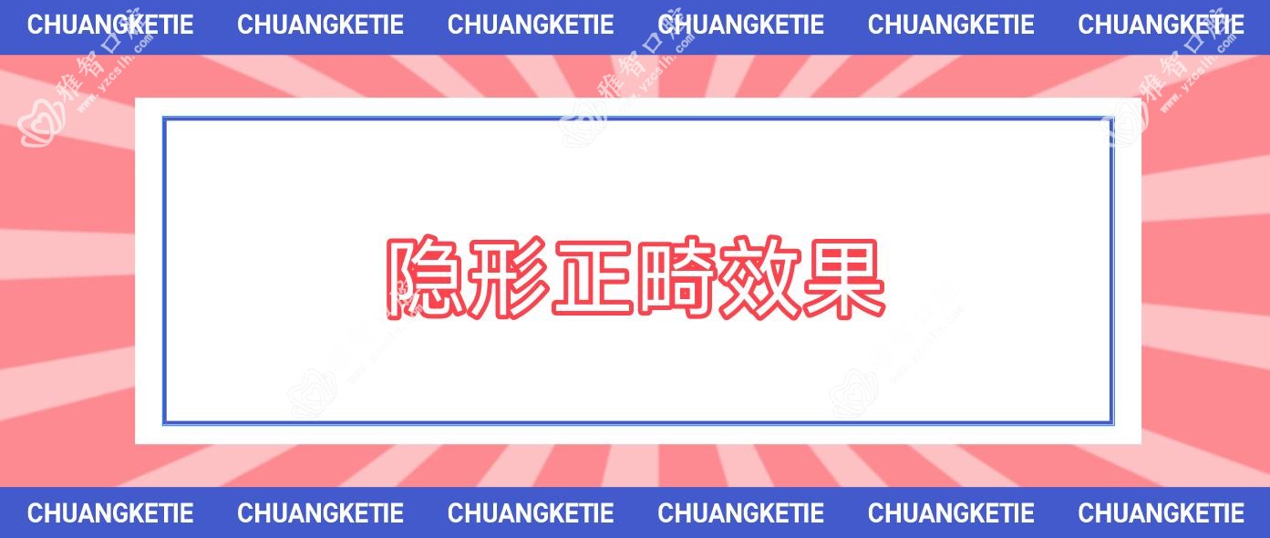 隐形正畸疗效