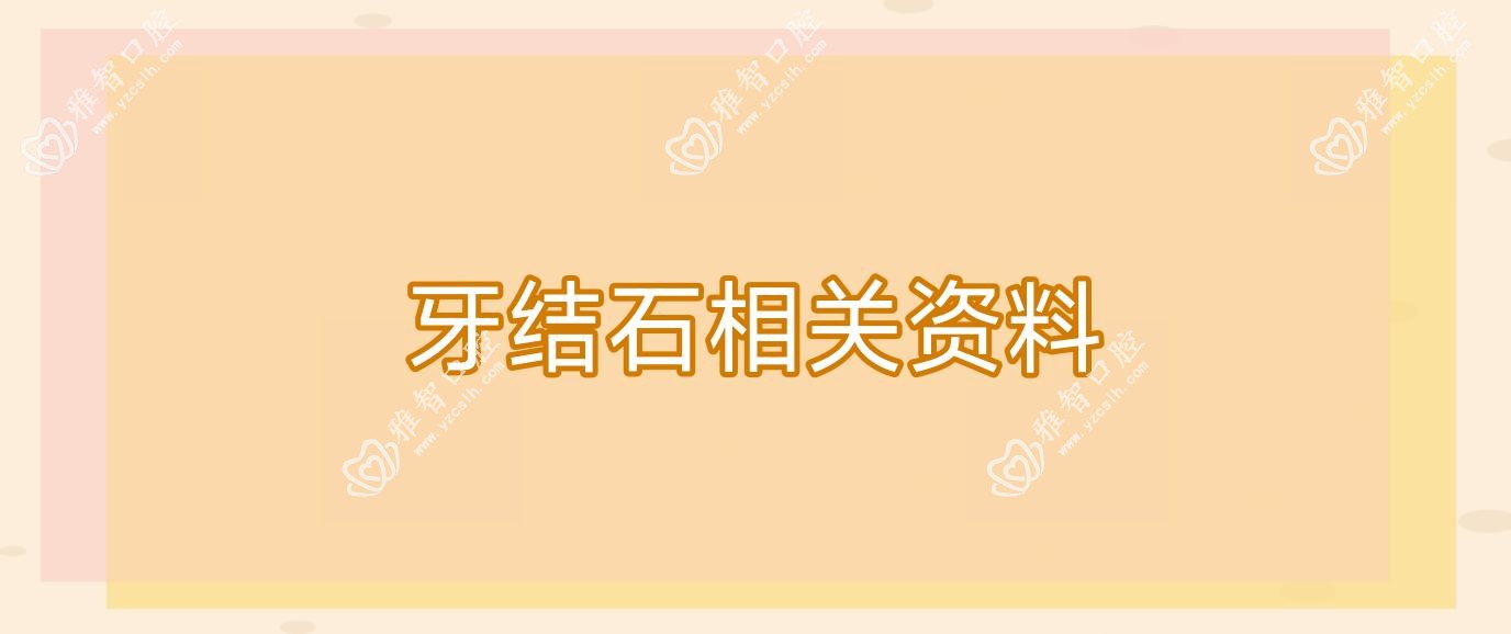 牙结石相关资料