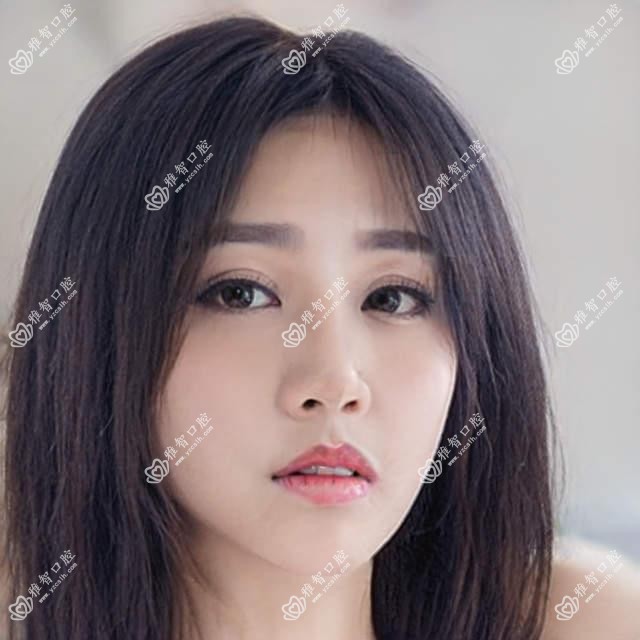 金华百特康种植系统正规费用明细2025新版,金华百特康种植系统/百特康种植系统多少钱