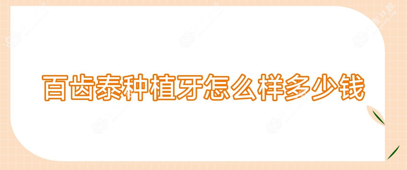 百齿泰种植牙怎么样多少钱