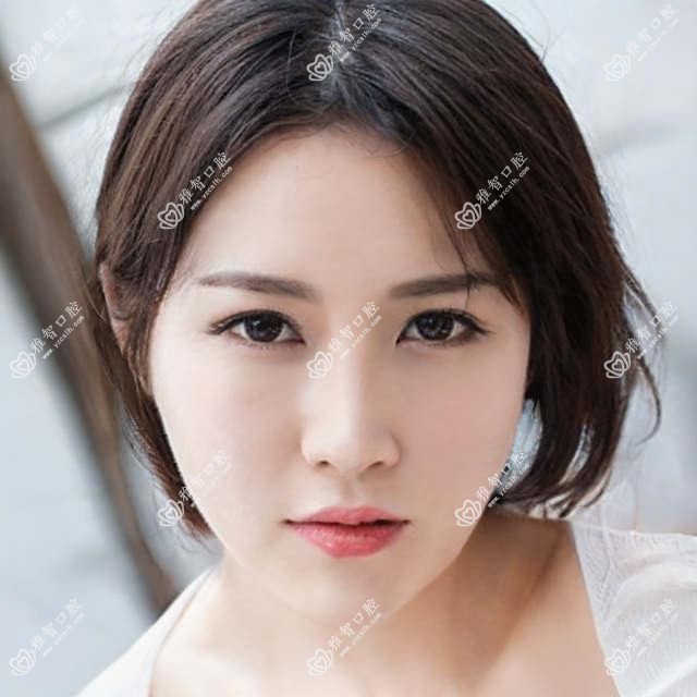 北京牙齿矫正收费表明细超人气2025(近六个月均价为:4568元)