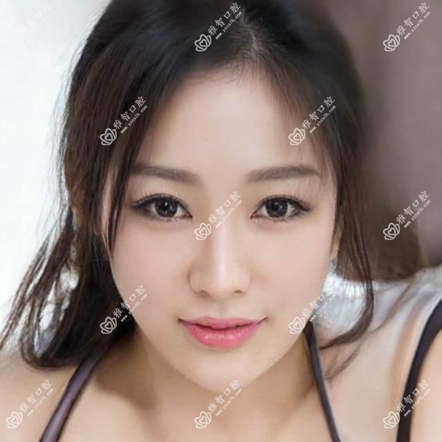 常州口腔修复价格表:310-1058元