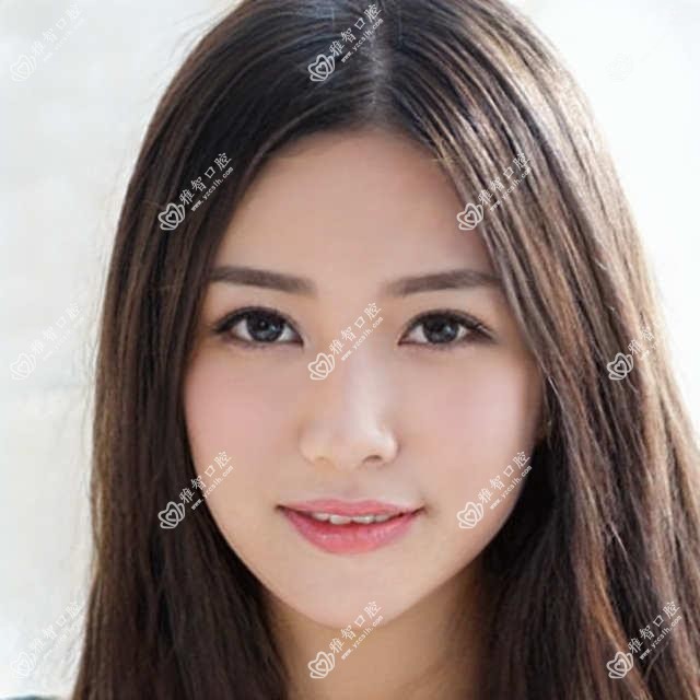 长沙做凸嘴牙齿矫正多少钱?快来看龅牙牙齿矫正和下巴后缩牙齿矫正价目表