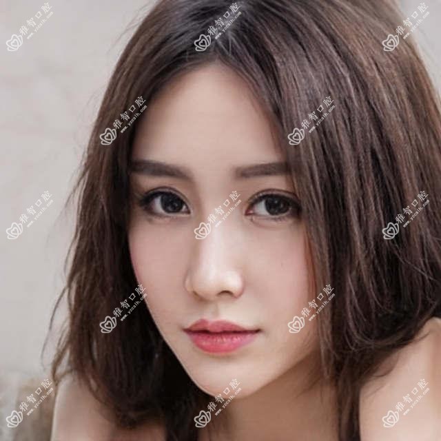 牙齿过敏可能性小的详细资料?牙齿过敏可能性小治疗方案推荐?