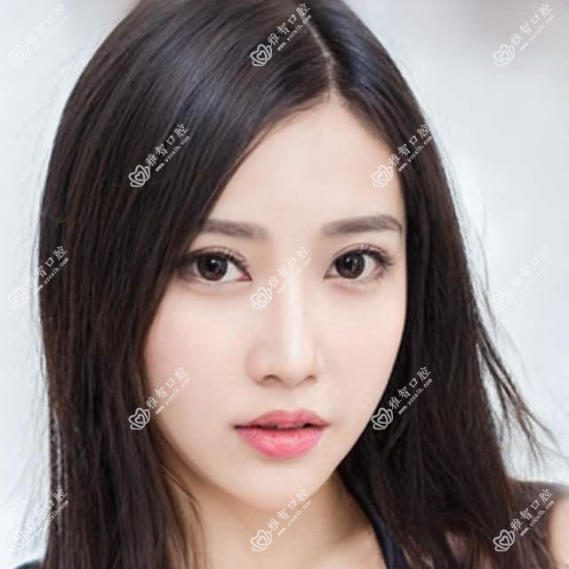 全口牙需要注意什么?全口牙好转方法详解?