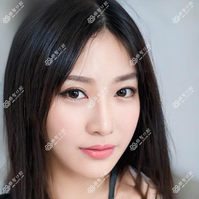 磨牙是什么,磨牙手术疼吗?以及恢复时间介绍
