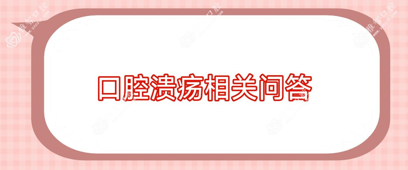 口腔溃疡相关问答
