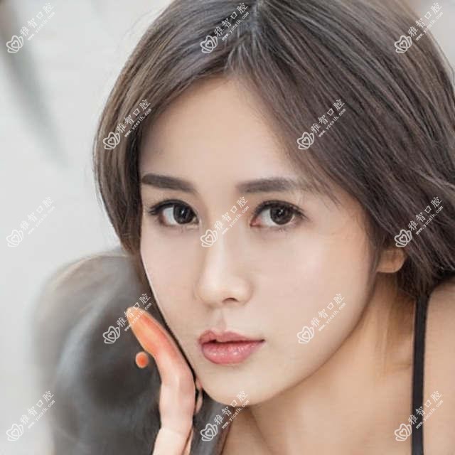 郑州半口即刻种植牙多少钱?2025年详细半口即刻种植牙收费表