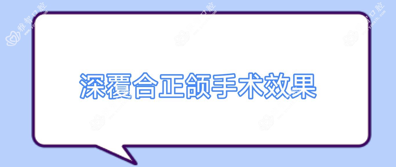 深覆合正颌手术疗效