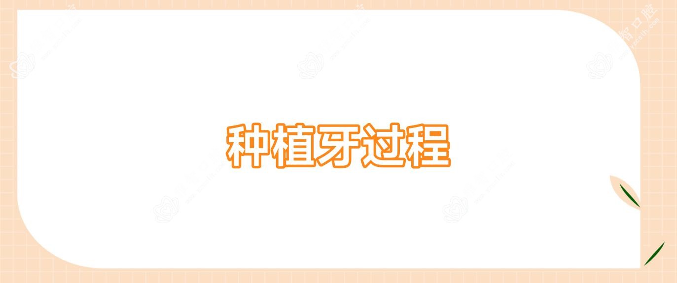 种植牙过程