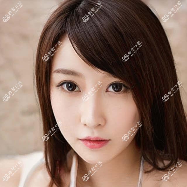 东莞牙齿美白价格多少钱？2025价格表：牙齿瓷贴面1.7k元起、皓齿美白0.6k元起