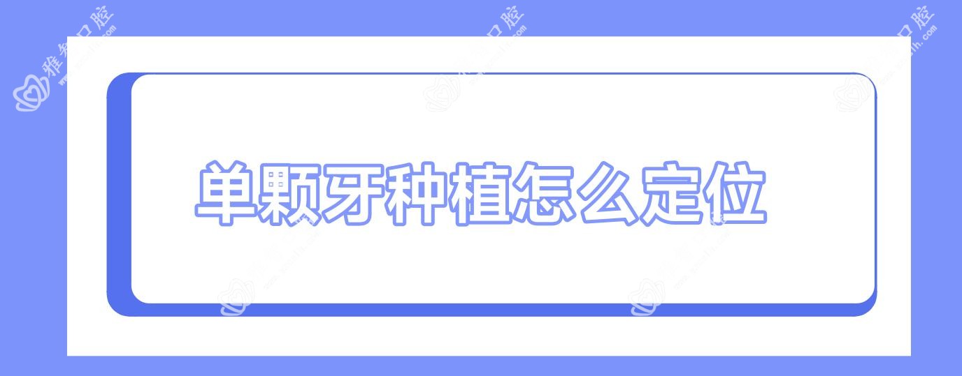 单颗牙种植怎么定位