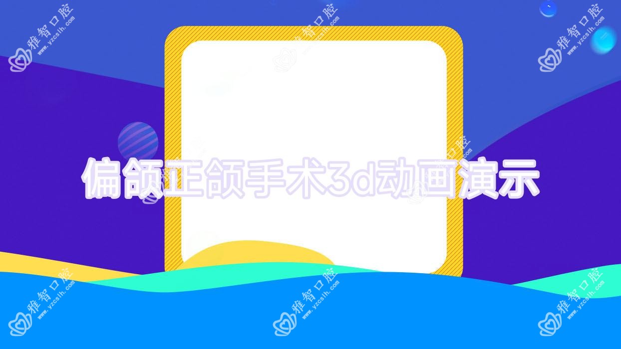 偏颌正颌手术3d动画演示